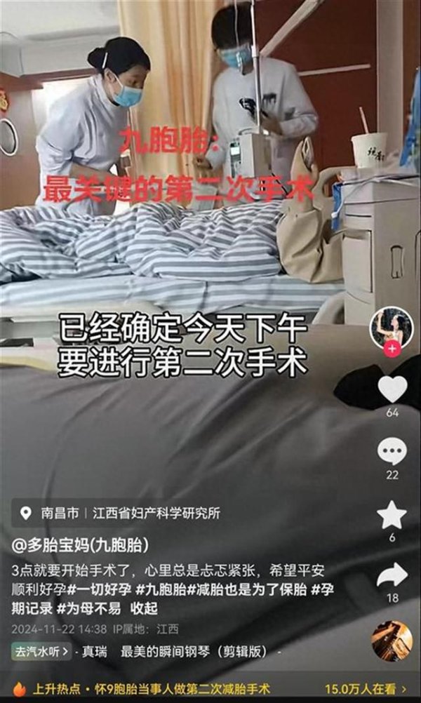 体育游戏app平台他称刚不久完成了减胎手术-开云「中国」kaiyun体育网址登录入口